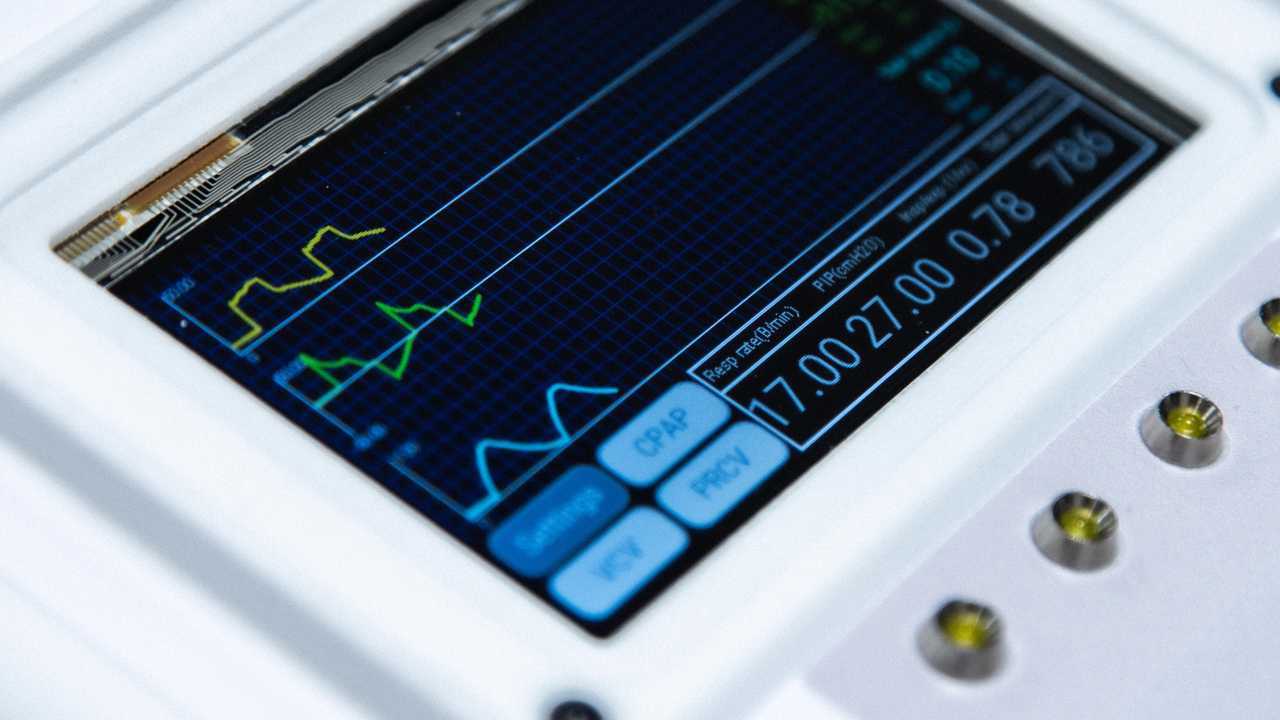 Ferrari unveils open-source ventilator for COVID-19 patients