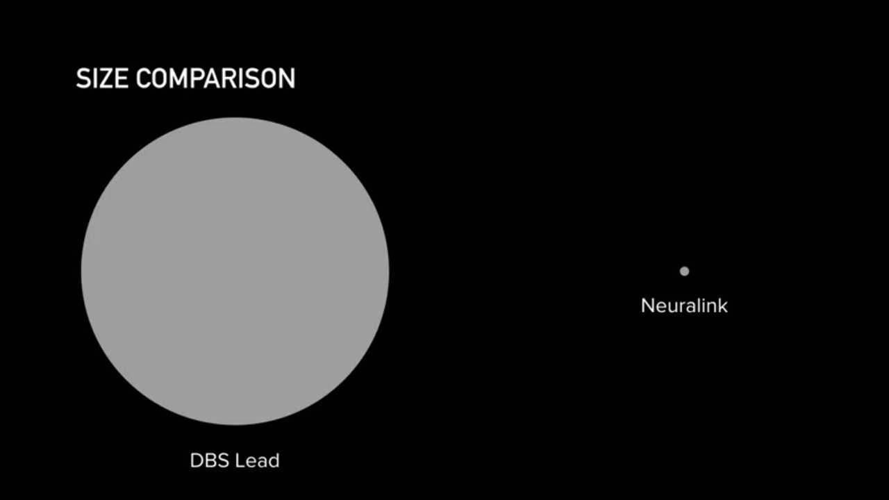 Elon Musk Presents Neuralink, A Revolutionary Brain Implant