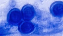 Guida alla lettura dei bollettini fitosanitari per peronospora e oidio, collegando rischio, stadio fenologico e strategie di difesa in vigneto