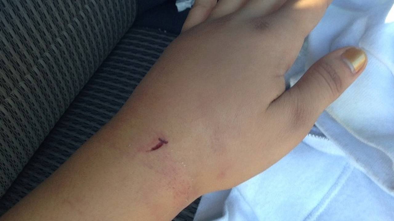 No, no it didn't buff out. I ended up with a fractured bone in my wrist. Do yourself a favor and invest the money for a good pair of gloves.