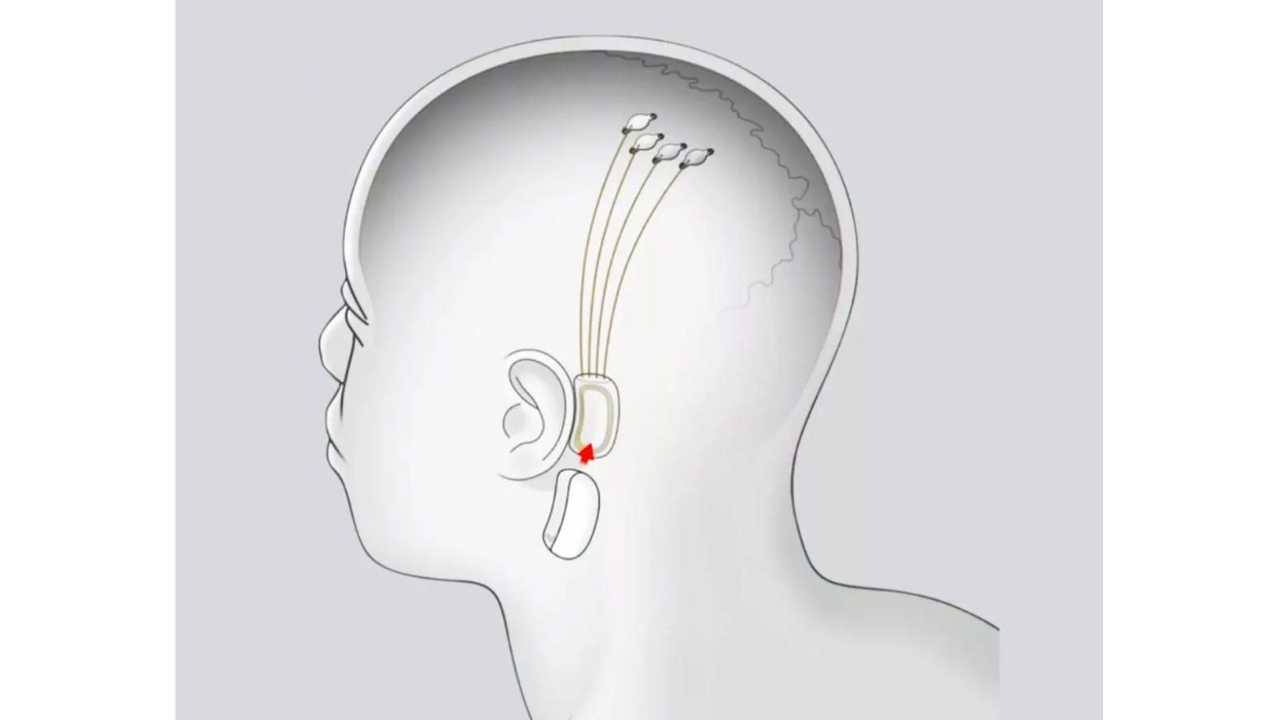 Elon Musk Neuralink